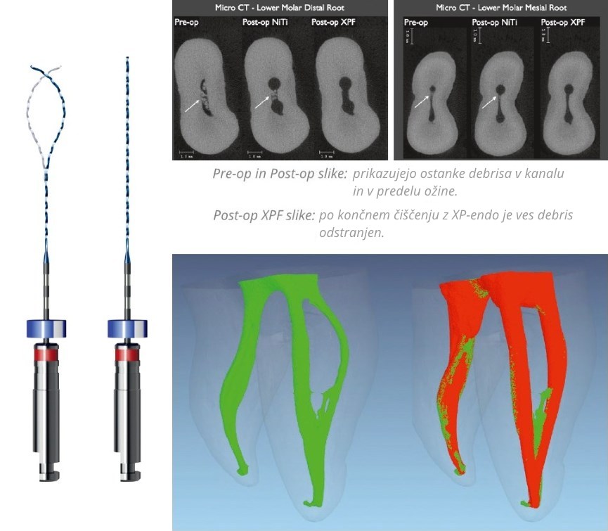 FKG XP-Endo