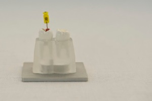 FotoSan630 razkuževanje endodontskega kanala korak 1