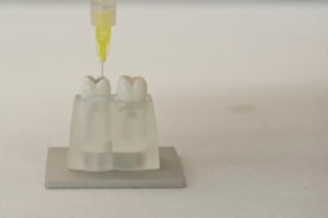 FotoSan630 razkuževanje endodontskega kanala korak 2