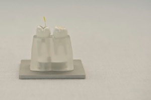 FotoSan630 razkuževanje endodontskega kanala korak 3