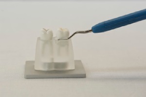 FotoSan630 zdravljenje periodontitisa korak 1