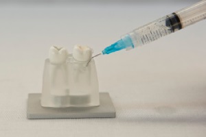 FotoSan630 zdravljenje periodontitisa korak 2
