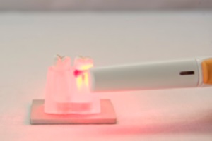 FotoSan630 zdravljenje periodontitisa korak 5