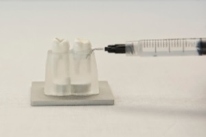FotoSan630 zdravljenje periodontitisa korak 6