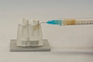 FotoSan630 zdravljenje periodontitisa korak 7